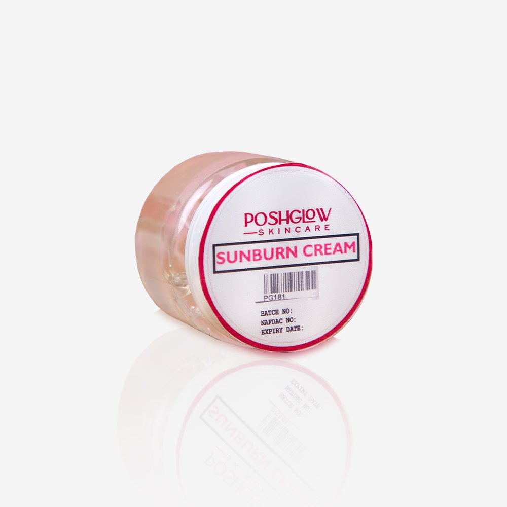 Sunburn Cream